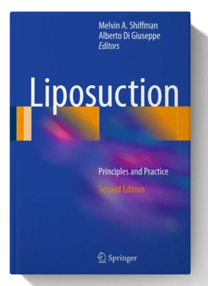 Liposuction: Principles and Practice